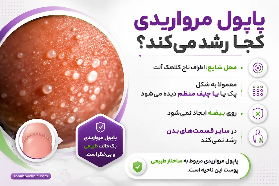 پاپول مرواریدی چیست؟ + علائم و علت پاپول مرواریدی مردانه 6 پاپول مرواریدی چیست؟ هر آن چیزی که باید بدانید