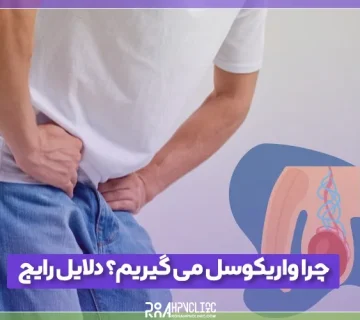 چرا واریکوسل می گیریم؟ مهم ترین علت های واریکوسل