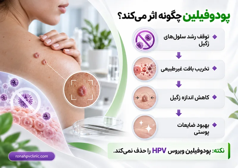 اثربخشی پودوفیلین بر زگیل تناسلی چگونه است؟ + راهنمای مصرف 6 اثربخشی پودوفیلین بر زگیل تناسلی چگونه است؟