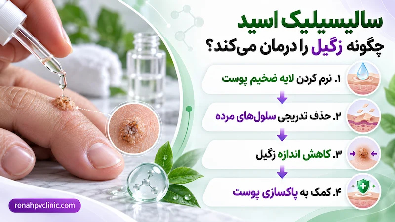 سالیسیلیک اسید برای زگیل | مراحل و نحوه استفاده 6 تاثیر اسید برای زگیل تناسلی