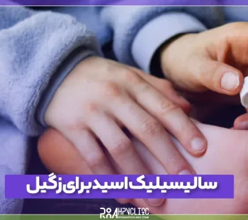 تاثیر سالیسیلیک اسید برای زگیل در نواحی مختلف بدن و نحوه استفاده
