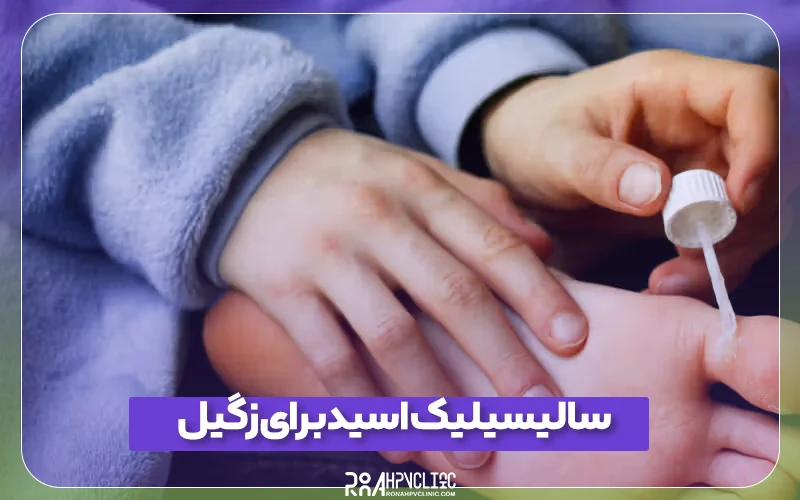 کلینیک hpv رونا 147 تاثیر سالیسیلیک اسید برای زگیل در نواحی مختلف بدن و نحوه استفاده