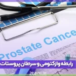 رابطه وازکتومی و سرطان پروستات چگونه است؟