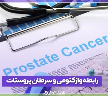 رابطه وازکتومی و سرطان پروستات چگونه است؟