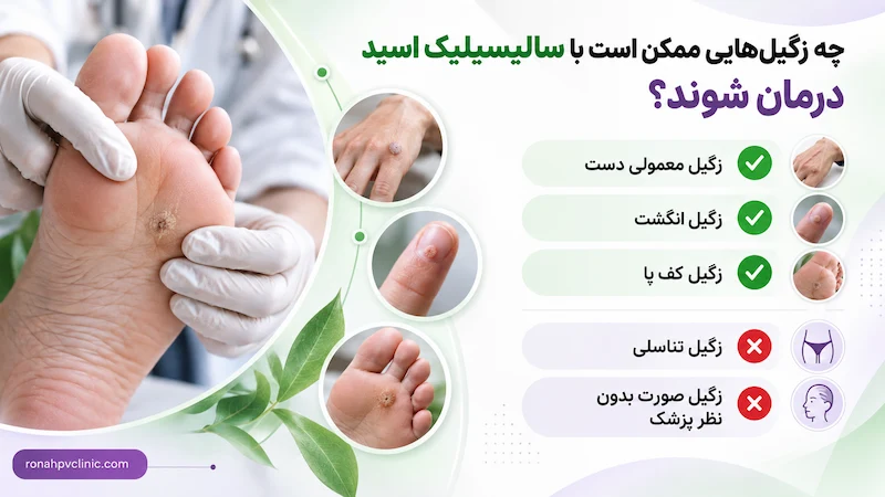 سالیسیلیک اسید برای زگیل | مراحل و نحوه استفاده 9 موارد استفاده از اسید برای زگیل در نواحی مختلف