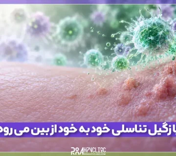 آیا زگیل تناسلی خود به خود از بین می رود؟
