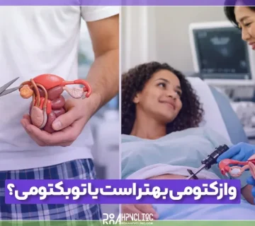 بستن لوله مردان بهتر است یا زنان؟
